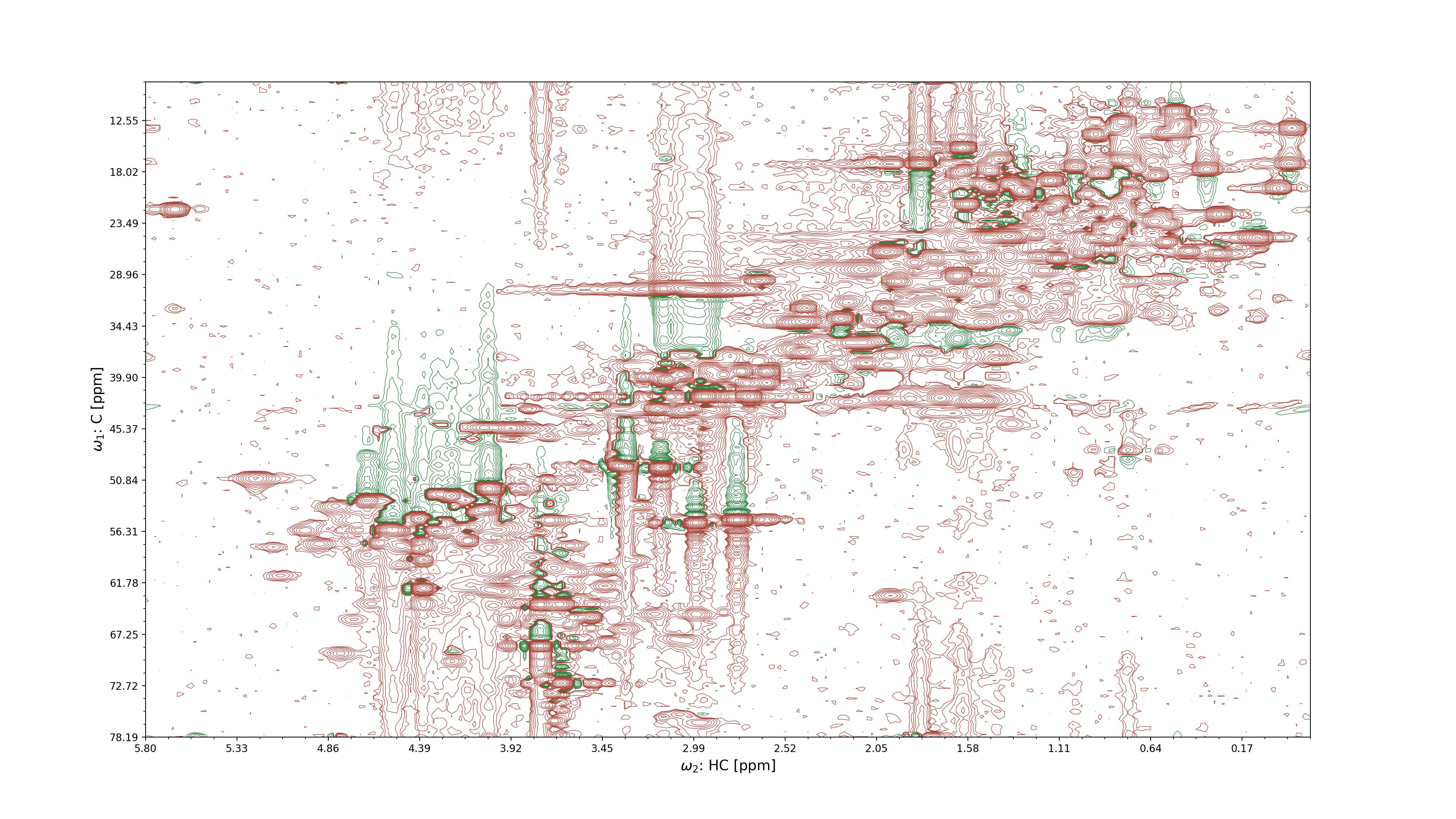 2D projection of an NMR spectrum